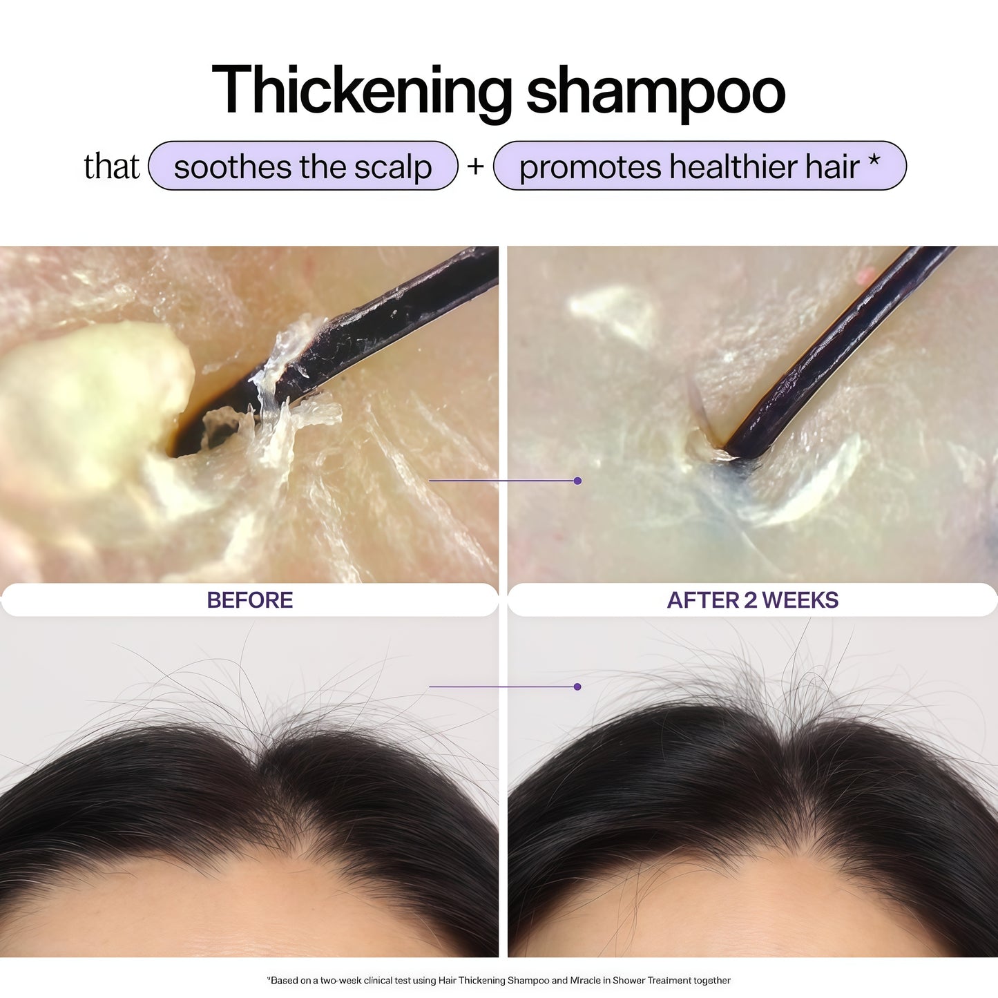 Dr. Groot Miracle in Shower Moisturizing Treatment for Hair Loss, Korean Hair Care Rinse, Rosemary Oil for Smooth, Healthier-Looking Hair in 5 Seconds, Scalp Revitalizing Solution